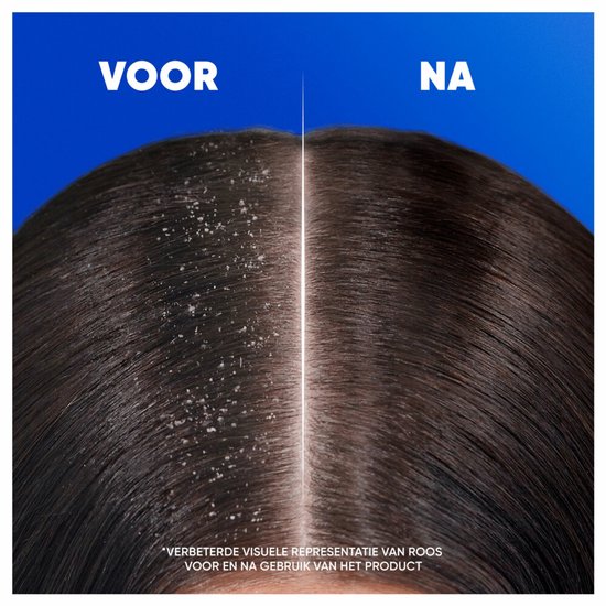 Head & Shoulders - Shampooing - Classic - 300 ml