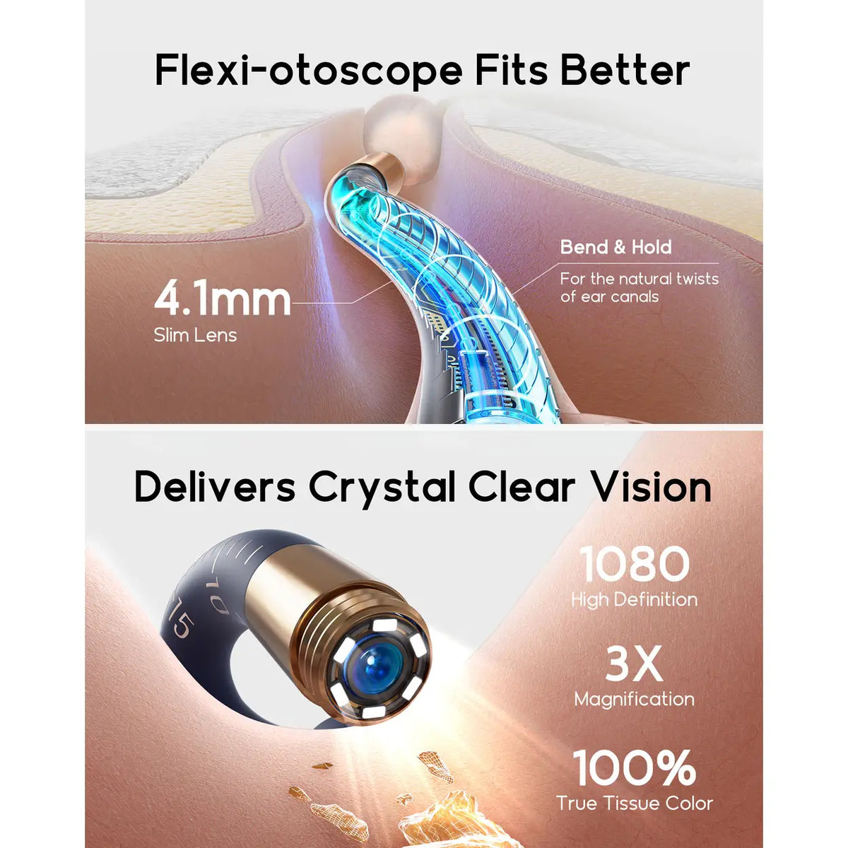 Otoscope bebird I35R - Caméra HD 1920P - Nettoyeur d'oreilles flexible avec embouts