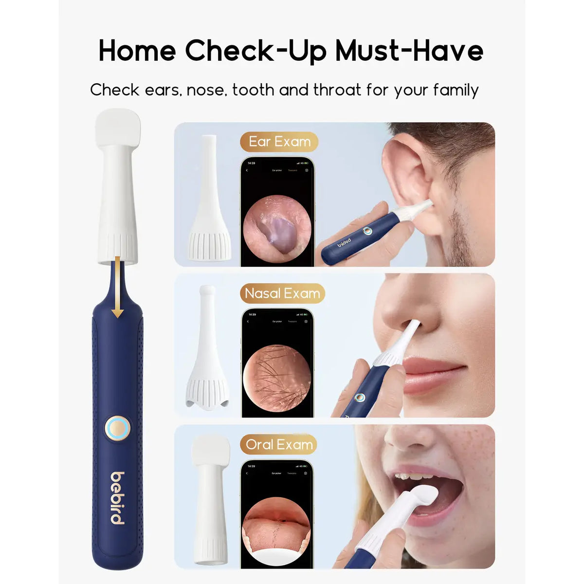 Otoscope bebird I35R - Caméra HD 1920P - Nettoyeur d'oreilles flexible avec embouts