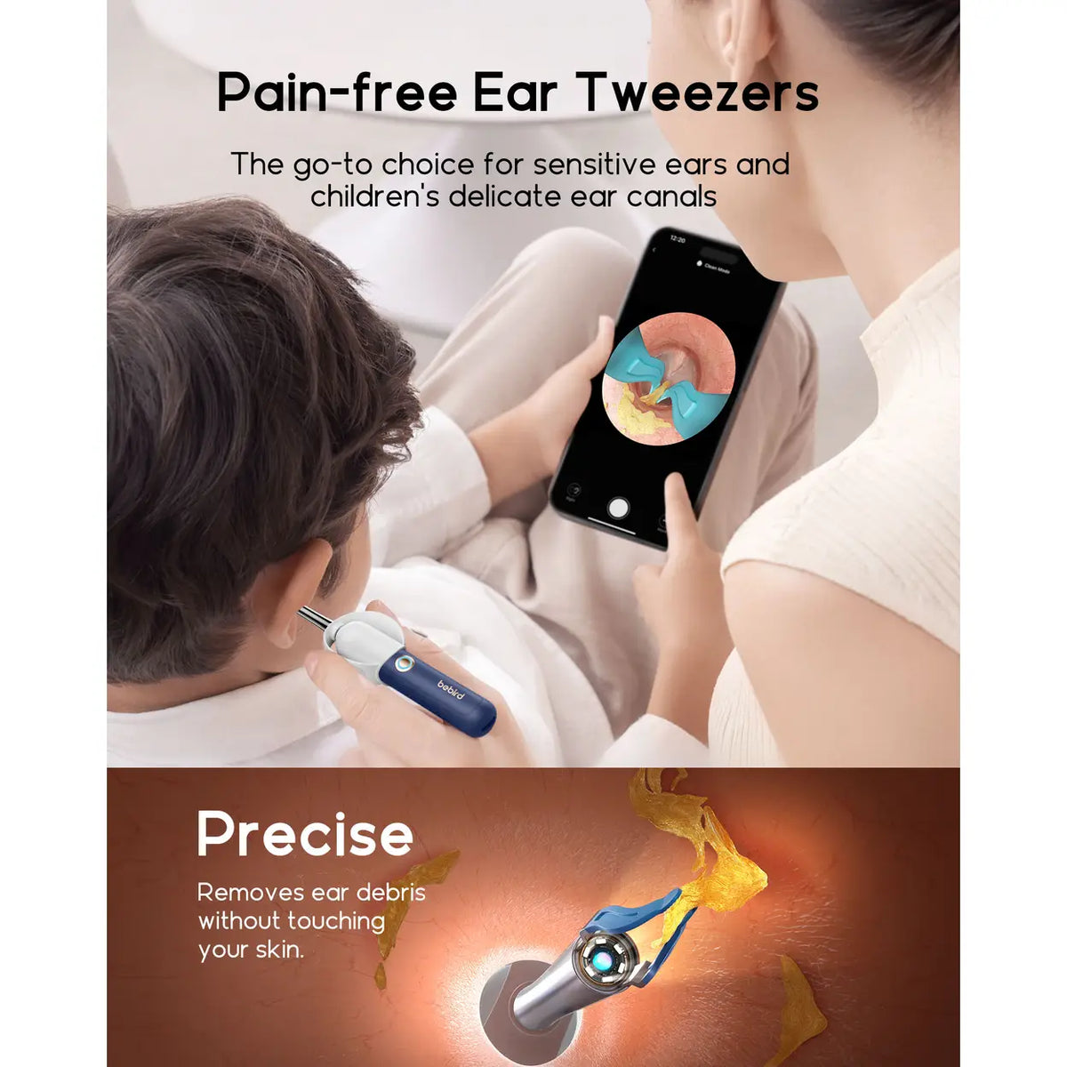 Otoscope bebird I35R - Caméra HD 1920P - Nettoyeur d'oreilles flexible avec embouts
