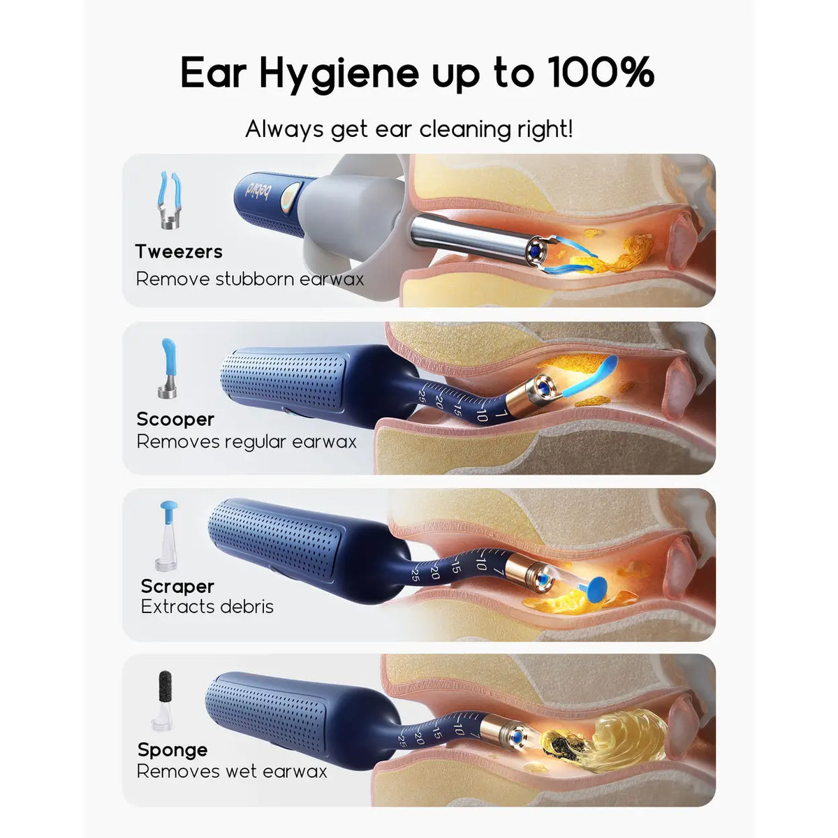 Otoscope bebird I35R - Caméra HD 1920P - Nettoyeur d'oreilles flexible avec embouts