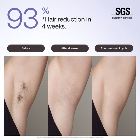 Ulike Air 3 - Appareil d'épilation IPL - Violet - épilation - épilation au laser - appareil IPL de pointe